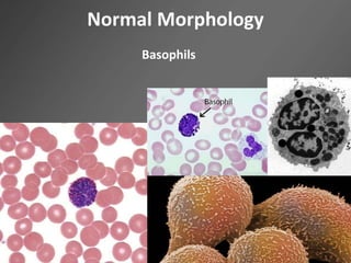 Normal Morphology
Basophils
 
