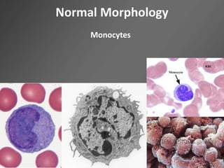Normal Morphology
Monocytes
 