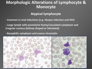 Morphologic Alterations of Lymphocyte &
Monocyte
Atypical lymphocyte
- Common in viral infections (e.g. Herpes infection and HIV)
- Large lymph with prominent foamy/vaculated cytoplasm and
irregular nucleus (kidney shaped or lobulated)
- Basophilic cytoplasm and coarse chromatin
 