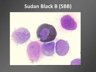 Sudan Black B (SBB)
 