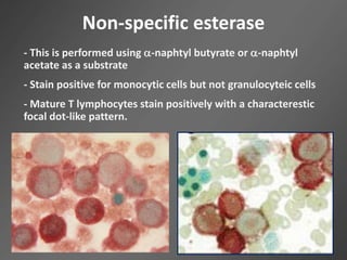 Non-specific esterase
- This is performed using -naphtyl butyrate or -naphtyl
acetate as a substrate
- Stain positive for monocytic cells but not granulocyteic cells
- Mature T lymphocytes stain positively with a characterestic
focal dot-like pattern.
 