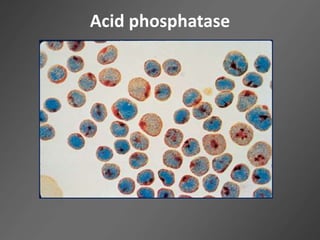 Acid phosphatase
 