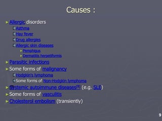 Causes :
►Allergic disorders
Asthma
Hay fever
Drug allergies
Allergic skin diseases
►Pemphigus
►Dermatitis herpetiformis
►Parasitic infections
►Some forms of malignancy
Hodgkin's lymphoma
Some forms of Non-Hodgkin lymphoma
►Systemic autoimmune diseases[8] (e.g. SLE)
►Some forms of vasculitis
►Cholesterol embolism (transiently)
9
 