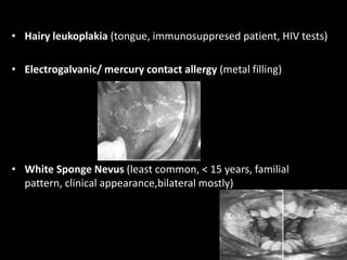 • Hairy leukoplakia (tongue, immunosuppresed patient, HIV tests)
• Electrogalvanic/ mercury contact allergy (metal filling)
• White Sponge Nevus (least common, < 15 years, familial
pattern, clinical appearance,bilateral mostly)
 