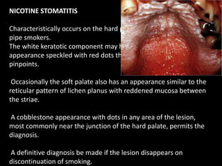 NICOTINE STOMATITIS
Characteristically occurs on the hard palate of smokers, usually
pipe smokers.
The white keratotic component may have a cobblestone
appearance speckled with red dots that may be the size of
pinpoints.
Occasionally the soft palate also has an appearance similar to the
reticular pattern of lichen planus with reddened mucosa between
the striae.
A cobblestone appearance with dots in any area of the lesion,
most commonly near the junction of the hard palate, permits the
diagnosis.
A definitive diagnosis be made if the lesion disappears on
discontinuation of smoking.
 