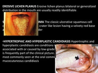 EROSIVE LICHEN PLANUS Erosive lichen planus bilateral or generalized
distribution in the mouth are usually readily identifiable
SQUAMOUS CELL CARCINOMA The classic ulcerative squamous cell
carcinoma is described as a crater like lesion having a velvety red base
and a rolled, indurated border
•HYPERTROPHIC AND HYPERPLASTIC CANDIDIASIS Hypertrophic and
hyperplastic candidiasis are conditions in which leukoplakial lesions are
associated with or caused by low-grade candidiasis. A red component
is frequently part of the clinical picture. Hyperplastic candidiasis is
most commonly seen at the oral commissures as angular cheilosis or
mucocutaneous candidiasis
 