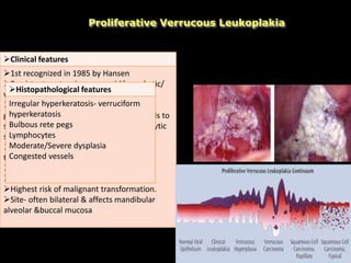 Proliferative Verrucous Leukoplakia
Clinical features
1st recognized in 1985 by Hansen
Persistent , extensive verrucoid/ exophytic/
wart like appearance
Begins as simple hyperkeratosis, slow-
growing, persistent & irreversible, but tends to
spread, becomes multifocal with an exophytic
surface.
Most commonly resistant to all forms of
therapy as recurrence is the rule.
Strong female predilection
> 60 years
Highest risk of malignant transformation.
Site- often bilateral & affects mandibular
alveolar &buccal mucosa
Histopathological features
Irregular hyperkeratosis- verruciform
hyperkeratosis
Bulbous rete pegs
Lymphocytes
Moderate/Severe dysplasia
Congested vessels
 