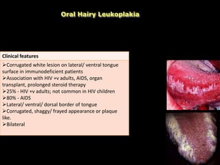 Oral Hairy Leukoplakia
Histopathological features
HPK, acanthosis, koliocytic cells (viral infected
Balloon Cells) in spinous layer
Homogenous viral nuclear inclusions with
residual rim of normal chromatin
Clinical features
Corrugated white lesion on lateral/ ventral tongue
surface in immunodeficient patients
Association with HIV +v adults, AIDS, organ
transplant, prolonged steroid therapy
25% - HIV +v adults; not common in HIV children
80% - AIDS
Lateral/ ventral/ dorsal border of tongue
Corrugated, shaggy/ frayed appearance or plaque
like.
Bilateral
 