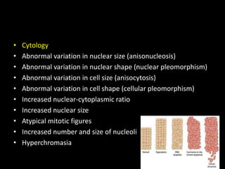 • Cytology
• Abnormal variation in nuclear size (anisonucleosis)
• Abnormal variation in nuclear shape (nuclear pleomorphism)
• Abnormal variation in cell size (anisocytosis)
• Abnormal variation in cell shape (cellular pleomorphism)
• Increased nuclear-cytoplasmic ratio
• Increased nuclear size
• Atypical mitotic figures
• Increased number and size of nucleoli
• Hyperchromasia
 