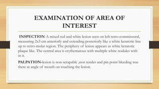 EXAMINATION OF AREA OF
INTEREST
INSPECTION-A mixed red and white lesion seen on left retro-commissural,
measuring 2x3 cm anteriorly and extending posteriorly like a white keratotic line
up to retro-molar region. The periphery of lesion appears as white keratotic
plaque like. The central area is erythematous with multiple white nodules with
in it.
PALPATION-lesion is non-scrapable ,non tender and pin point bleeding was
there at angle of mouth on touching the lesion.
 