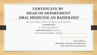 CERTIFICATE BY
HEAD OF DEPARTMENT
ORAL MEDICINE AN RADIOLOGY
THIS IS TO CERTIFY THAT THE SPECIAL CASE ENTITLED
“LEUKOPLAKIA”
IS A GENUINE WORK OF
ASHUTOSH YADAV, BATCH 2017,
HE HAS BEEN AWARDED _ GRADE
DR.NAGARAJU K.
PROFESSOR AND HEAD OF DEPARTMENT
ORAL MEDICINE AND RADIOLOGY
 