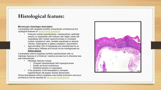 Histological feature:
Microscopic (histologic) description
•Leukoplakia with dysplasia exhibits characteristic architectural and
cytological features of keratinizing dysplasia
• Features include hyperkeratosis / parakeratosis, epithelial
atrophy or hyperplasia with bulbous rete ridges, basal cell
hyperplasia with nuclear hyperchromasia or increased
nuclear cytoplasmic ratio, variable suprabasal or atypical
mitoses, dyskeratosis or glassy cytoplasm, dyscohesion
• Approximately 33% of dysplasias are characterized by an
inflammatory infiltrate and should not be misdiagnosed as
lichen planus
•Leukoplakia without dysplasia exhibits hyperkeratosis with no
histologic features of a frictional / reactive process but is otherwise less
well characterized
• Histologic features include
• Compact hyperkeratosis with hypergranulosis
• Subtle verrucoid architecture
• Epithelial atrophy or hyperplasia
• If the periphery of the leukoplakia is sampled,
hyperkeratosis will appear sharply demarcated
•Some leukoplakias without dysplasia may exhibit prominent verrucous
architecture and be reported as verrucous hyperplasia
 