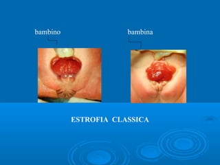 bambino               bambina




          ESTROFIA CLASSICA
 