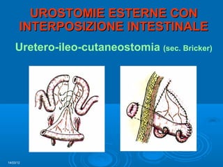 UROSTOMIE ESTERNE CON
       INTERPOSIZIONE INTESTINALE
    Uretero-ileo-cutaneostomia (sec. Bricker)




14/03/12
 