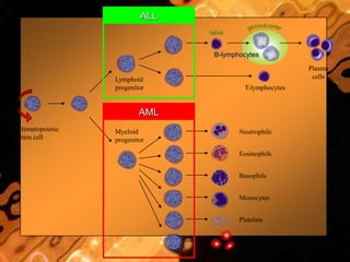 Hematopoietic
stem cell
Neutrophils
Eosinophils
Basophils
Monocytes
Platelets
Red cells
Myeloid
progenitor
Lymphoid
progenitor
B-lymphocytes
T-lymphocytes
Plasma
cells
naïve
ALL
AML
 