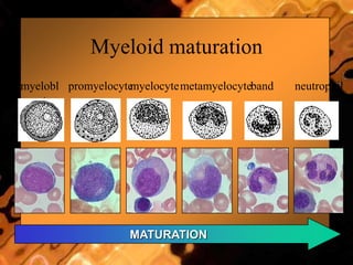 Myeloid maturation
myelobl
ast
promyelocytemyelocytemetamyelocyteband neutrophil
MATURATION
Adapted and modified from U Va website
 