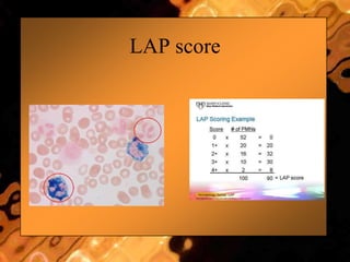 LAP score
 