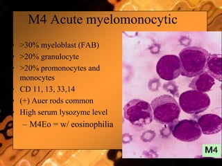 M4 Acute myelomonocytic
• >30% myeloblast (FAB)
• >20% granulocyte
• >20% promonocytes and
monocytes
• CD 11, 13, 33,14
• (+) Auer rods common
• High serum lysozyme level
– M4Eo = w/ eosinophilia
 