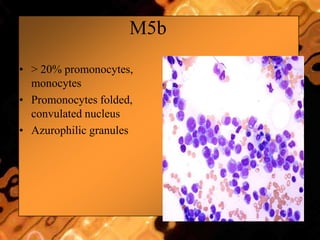 M5b
• > 20% promonocytes,
monocytes
• Promonocytes folded,
convulated nucleus
• Azurophilic granules
 