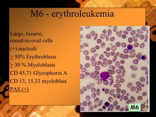 M6 - erythroleukemia
 Large, bizarre,
round-to-oval cells
 (+) nucleoli
 > 50% Erythroblasts
 > 30 % Myeloblasts
 CD 45,71 Glycophorin A
 CD 13, 15,33 myeloblast
 PAS (+)
 