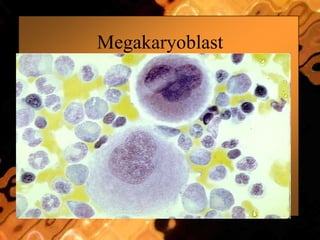 Megakaryoblast
 