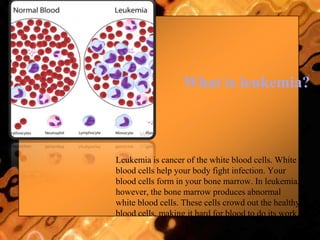 What is leukemia?
Leukemia is cancer of the white blood cells. White
blood cells help your body fight infection. Your
blood cells form in your bone marrow. In leukemia,
however, the bone marrow produces abnormal
white blood cells. These cells crowd out the healthy
blood cells, making it hard for blood to do its work.
 