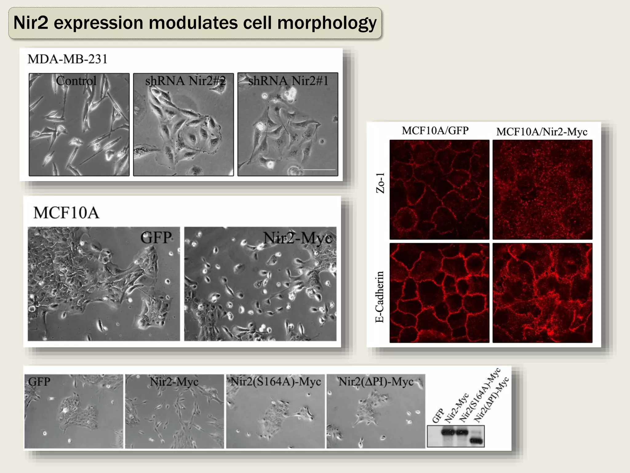 Photo inspiration: Gallery Detail: Professor Sima Lev Epithelial Mesenchymal Transition Emt