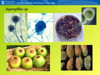 Aspergillus sp . Dra. M. L. Ortiz. Dep. Microbiología y Parasitología 
