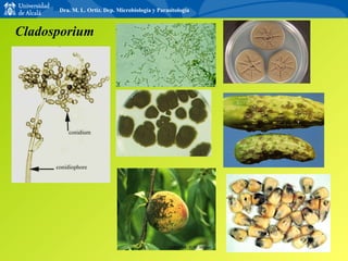 Cladosporium Dra. M. L. Ortiz. Dep. Microbiología y Parasitología 
