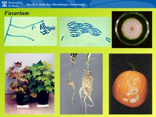 Fusarium Dra. M. L. Ortiz. Dep. Microbiología y Parasitología 