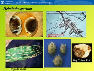 Hoja de maiz Helminthosporium Dra. M. L. Ortiz. Dep. Microbiología y Parasitología 