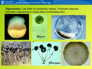 Zigomicetos : Las hifas no presentan septos. Producen esporas sexuales (zigosporas) o asexuales (conidioesporas). Mucor Rhizopus Dra. M. L. Ortiz. Dep. Microbiología y Parasitología 