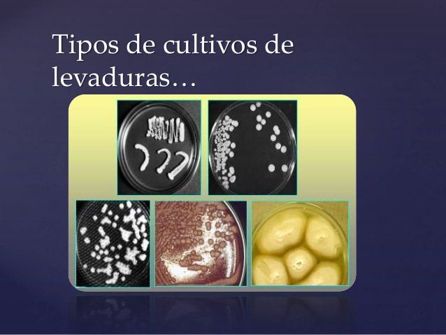 Levaduras.