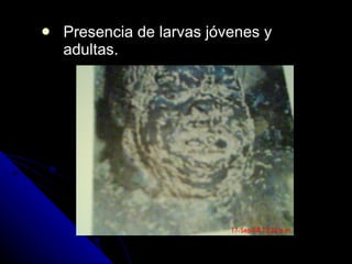 Presencia de larvas jóvenes y adultas. 
