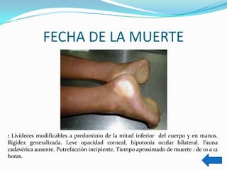FECHA DE LA MUERTE




: Livideces modificables a predominio de la mitad inferior del cuerpo y en manos.
Rigidez generalizada. Leve opacidad corneal, hipotonía ocular bilateral. Fauna
cadavérica ausente. Putrefacción incipiente. Tiempo aproximado de muerte : de 10 a 12
horas.
 
