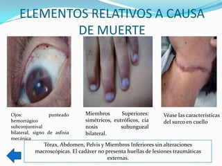 ELEMENTOS RELATIVOS A CAUSA
           DE MUERTE




Ojos:             punteado     Miembros       Superiores:       Véase las características
hemorrágico                    simétricos, eutróficos, cia      del surco en cuello
subconjuntival                 nosis          subungueal
bilateral, signo de asfixia    bilateral.
mecánica
              Tórax, Abdomen, Pelvis y Miembros Inferiores sin alteraciones
           macroscópicas. El cadáver no presenta huellas de lesiones traumáticas
                                         externas.
 
