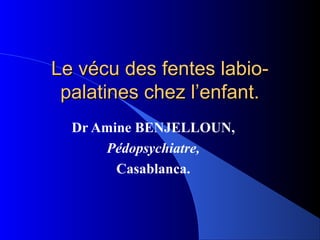 Le vécu des fentes labio-
 palatines chez l’enfant.
  Dr Amine BENJELLOUN,
      Pédopsychiatre,
        Casablanca.
 