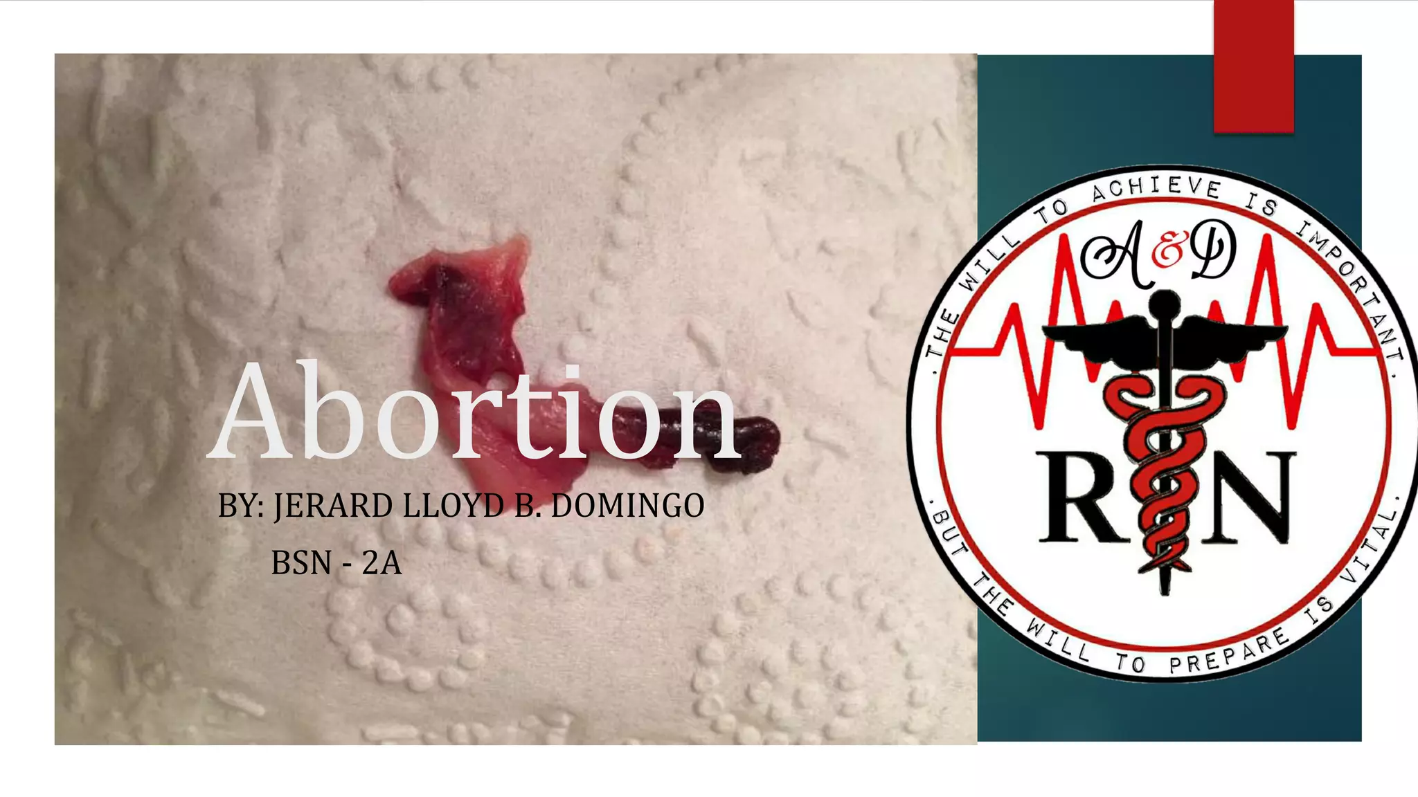 Abortion
BY: JERARD LLOYD B. DOMINGO
BSN - 2A
 