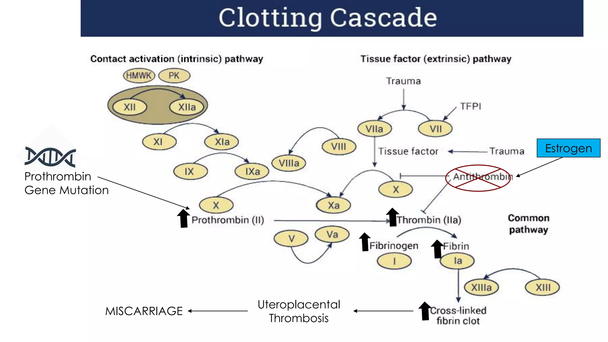 Prothrombin
Gene Mutation
Estrogen
Uteroplacental
Thrombosis
MISCARRIAGE
 