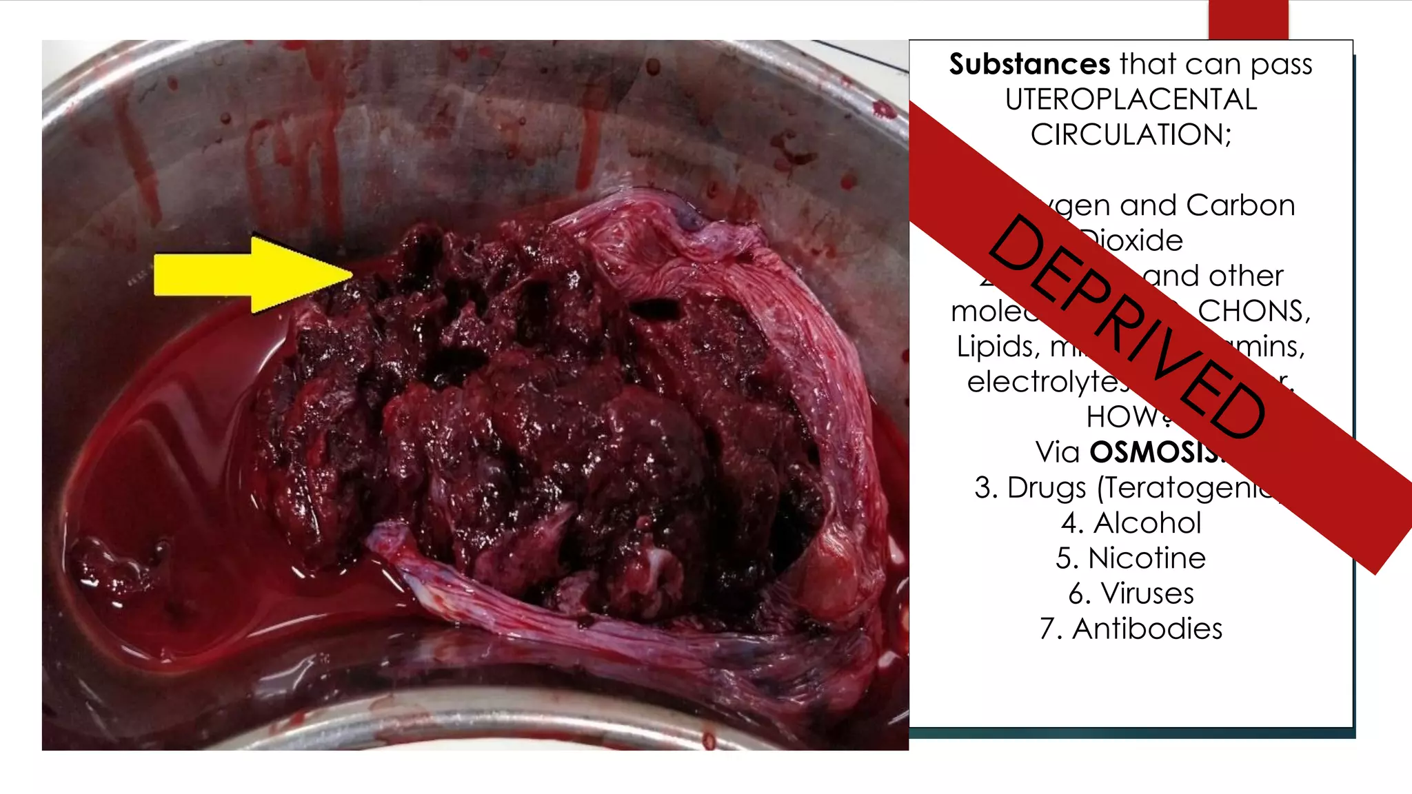 Substances that can pass
UTEROPLACENTAL
CIRCULATION;
1. Oxygen and Carbon
Dioxide
2. Nutrients and other
molecules; CHO, CHONS,
Lipids, minerals, vitamins,
electrolytes and water.
HOW?
Via OSMOSIS.
3. Drugs (Teratogenic)
4. Alcohol
5. Nicotine
6. Viruses
7. Antibodies
 
