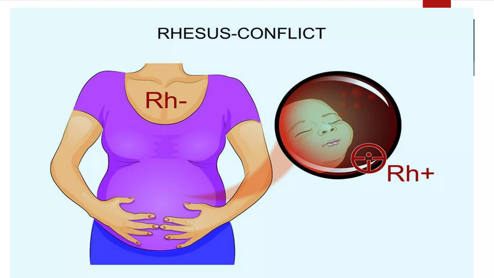 8. Allo-immune Factors
 Alloimunity or isoimmunity – another autoimmune response.
- It is an immune response to non-self antigens from members of the same species,
which are called allo antigens or iso antigens.
*Alloimmunity – refers to the immune response to the antigen of the baby that results in
deterioration of the fetus.
*Allo-immunity is a result of Maternal Immune Response that resulted in isoimmunization.
For example, when the mother is Rh- and the fetus is Rh+ isoimmunization occurs as
situations that causes mixing of maternal and fetal blood occurs such labour and
delivery. Isoimmunization is recognized by T-lymphocyte Activating System.
*Allo – other
*Auto – self
 