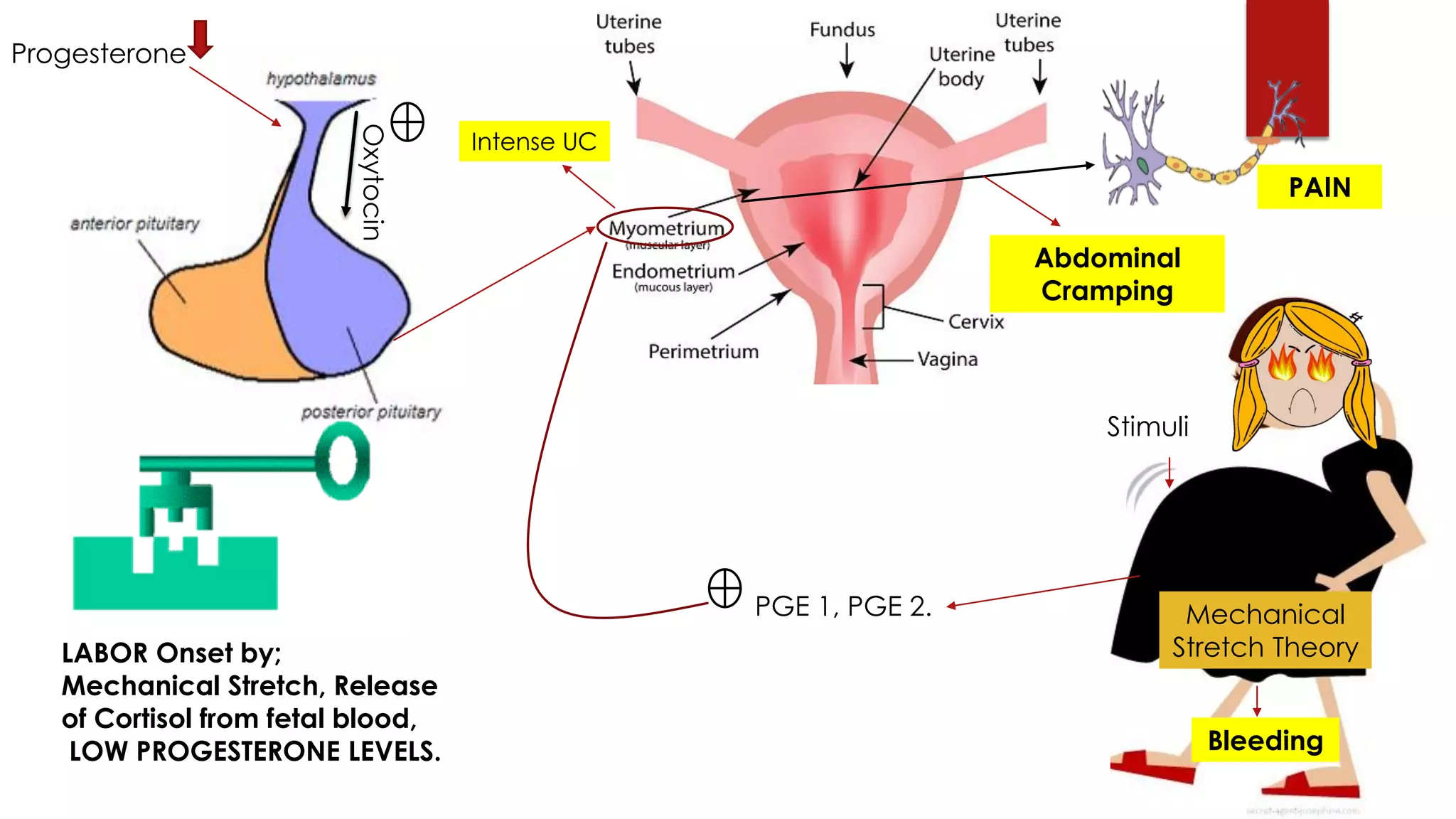 Oxytocin
Mechanical
Stretch Theory
Progesterone
Stimuli
PGE 1, PGE 2.
PAIN
Abdominal
Cramping
Bleeding
LABOR Onset by;
Mechanical Stretch, Release
of Cortisol from fetal blood,
LOW PROGESTERONE LEVELS.
Intense UC
 