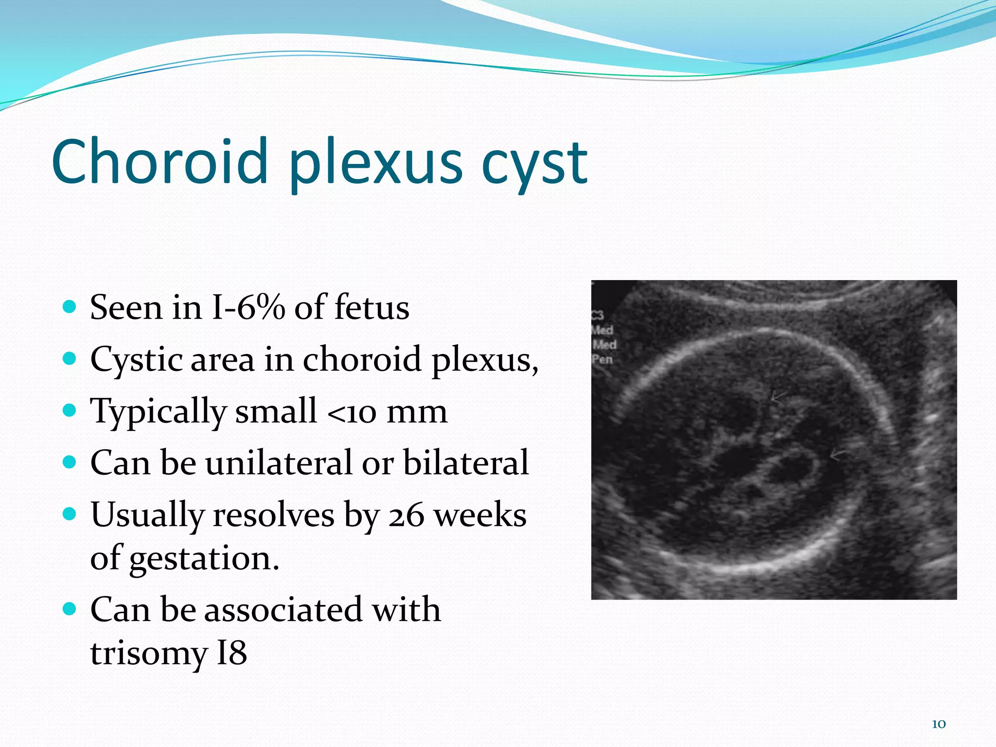 Choroid plexus cyst
 Seen in I-6% of fetus
 Cystic area in choroid plexus,
 Typically small <10 mm
 Can be unilateral or bilateral
 Usually resolves by 26 weeks
  of gestation.
 Can be associated with
  trisomy I8
                                   10
 