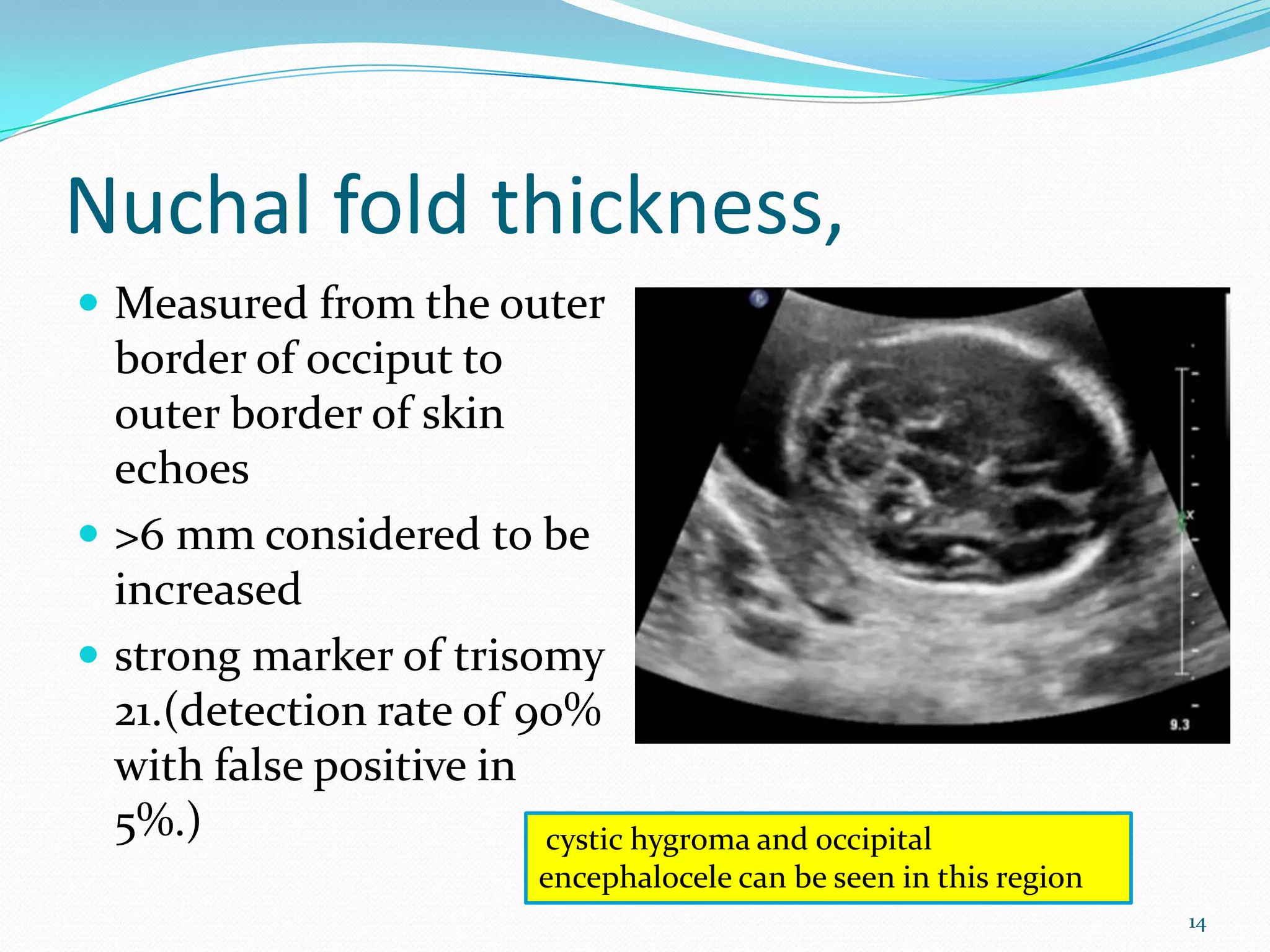 Nuchal fold thickness,
 Measured from the outer
  border of occiput to
  outer border of skin                                        Image
  echoes
 >6 mm considered to be
  increased
 strong marker of trisomy
  21.(detection rate of 90%
  with false positive in
  5%.)                   cystic hygroma and occipital
                            encephalocele can be seen in this region
                                                                       14
 