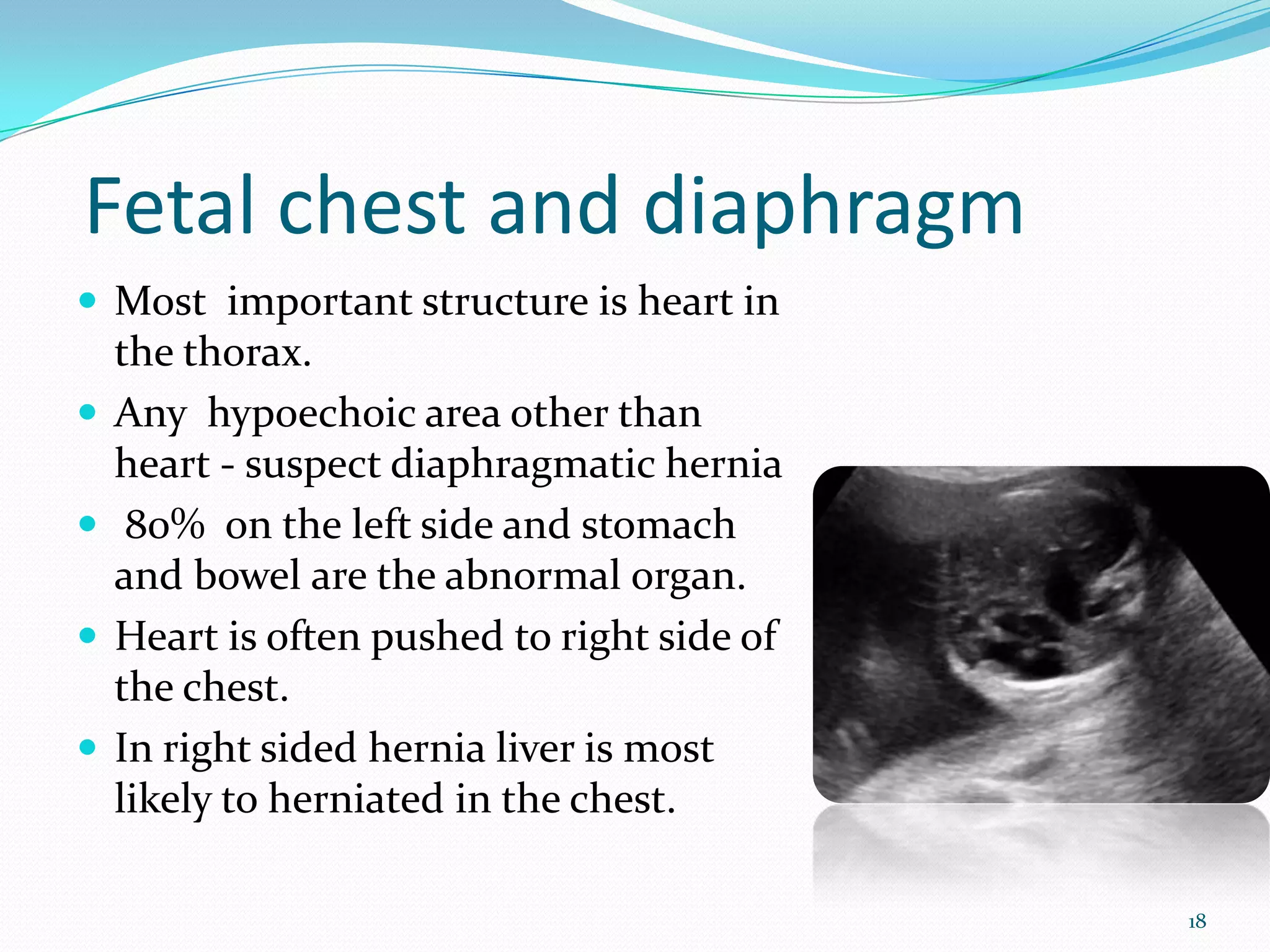 Fetal chest and diaphragm
 Most important structure is heart in
    the thorax.
   Any hypoechoic area other than
    heart - suspect diaphragmatic hernia
    80% on the left side and stomach
    and bowel are the abnormal organ.
   Heart is often pushed to right side of
    the chest.
   In right sided hernia liver is most
    likely to herniated in the chest.

                                             18
 