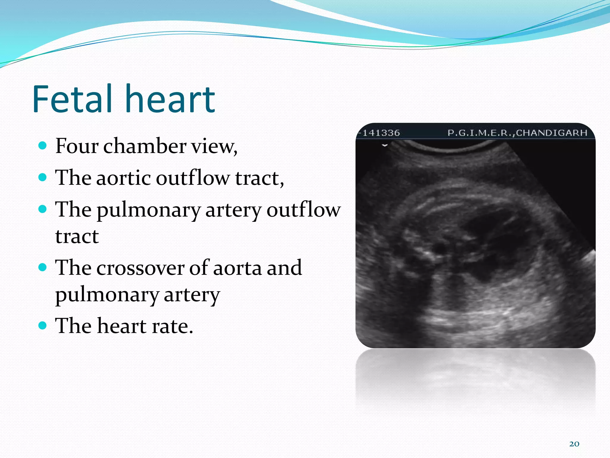 Fetal heart
 Four chamber view,
 The aortic outflow tract,
 The pulmonary artery outflow
  tract
 The crossover of aorta and
  pulmonary artery
 The heart rate.




                                 20
 