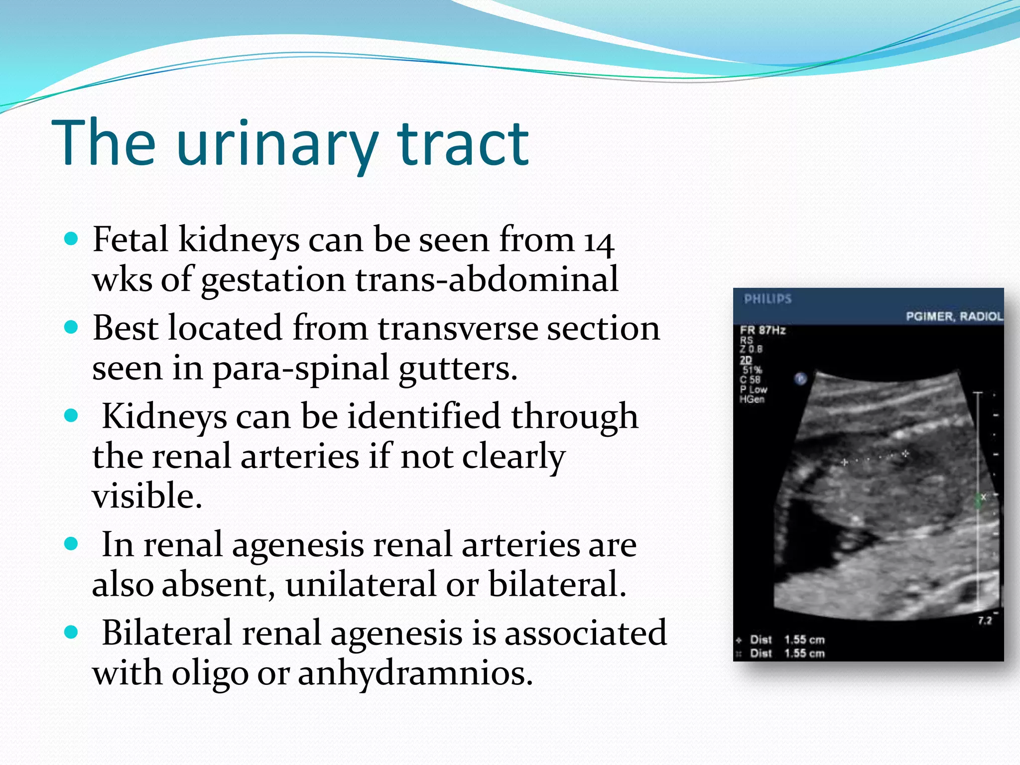 The urinary tract
 Fetal kidneys can be seen from 14
    wks of gestation trans-abdominal
   Best located from transverse section
    seen in para-spinal gutters.
    Kidneys can be identified through
    the renal arteries if not clearly
    visible.
    In renal agenesis renal arteries are
    also absent, unilateral or bilateral.
    Bilateral renal agenesis is associated
    with oligo or anhydramnios.
 
