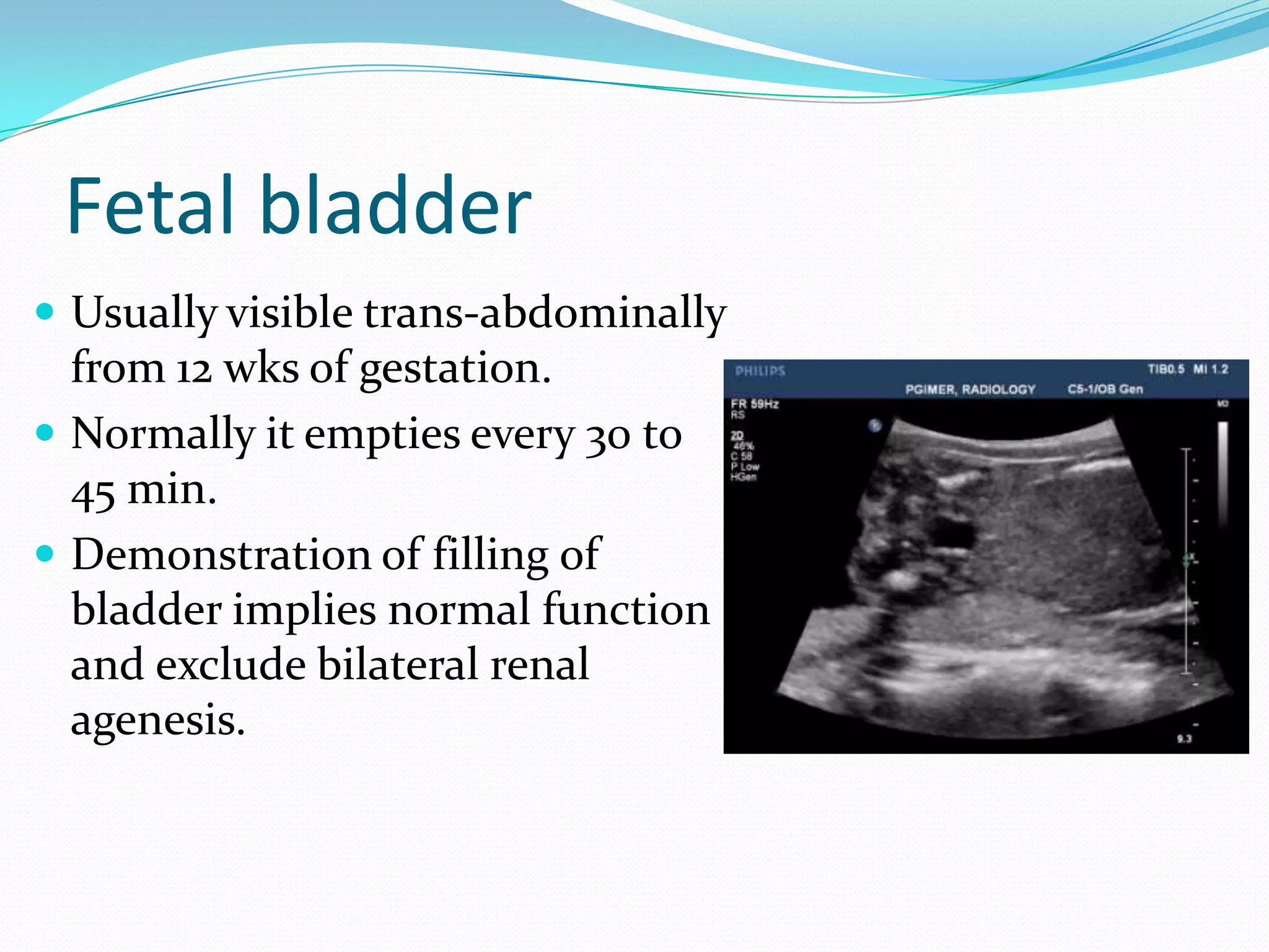 Fetal bladder
 Usually visible trans-abdominally
  from 12 wks of gestation.
 Normally it empties every 30 to
  45 min.
 Demonstration of filling of
  bladder implies normal function
  and exclude bilateral renal
  agenesis.
 