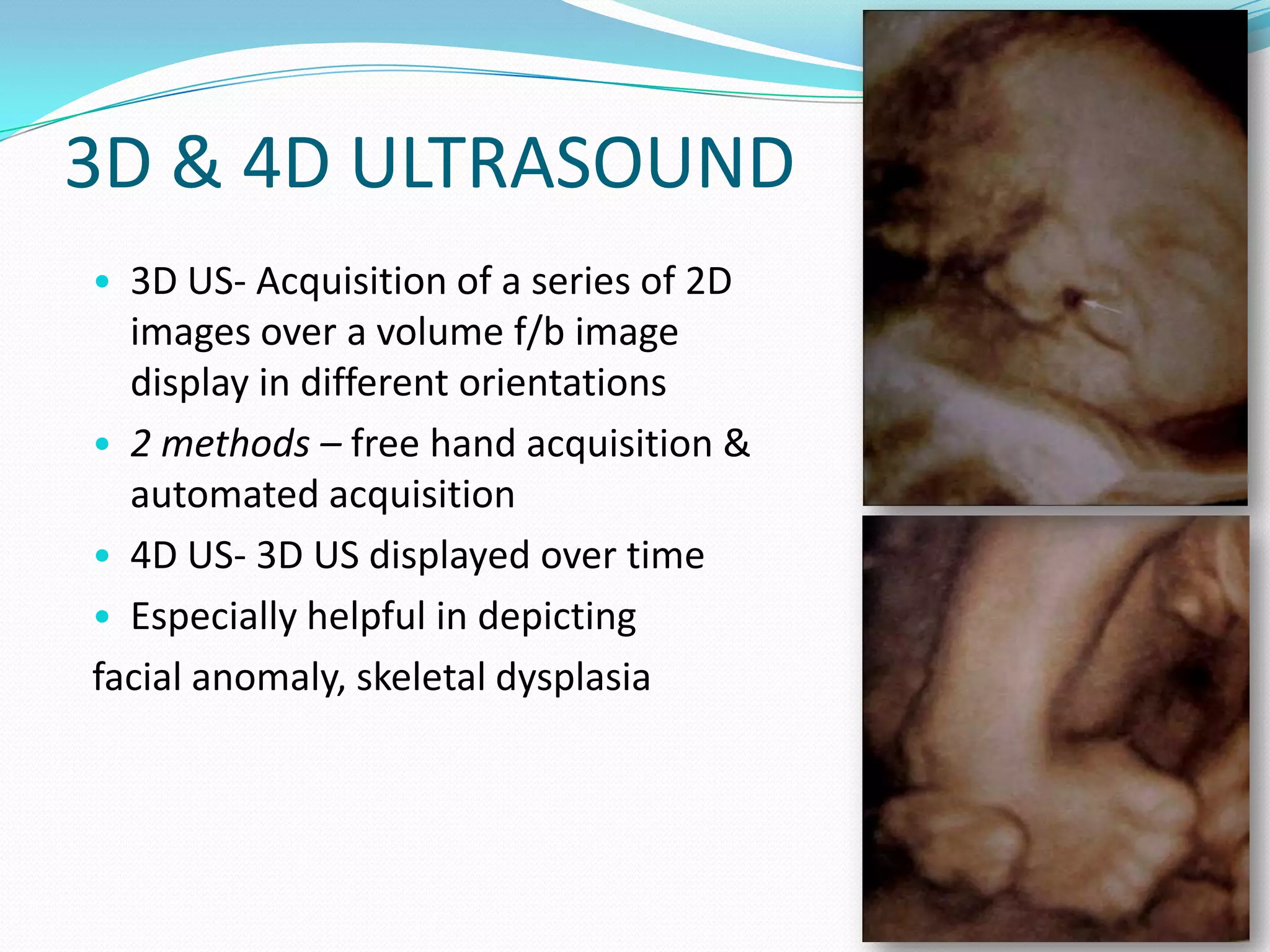 3D & 4D ULTRASOUND
• 3D US- Acquisition of a series of 2D
  images over a volume f/b image
  display in different orientations
• 2 methods – free hand acquisition &
  automated acquisition
• 4D US- 3D US displayed over time
• Especially helpful in depicting
facial anomaly, skeletal dysplasia




                                         46
 