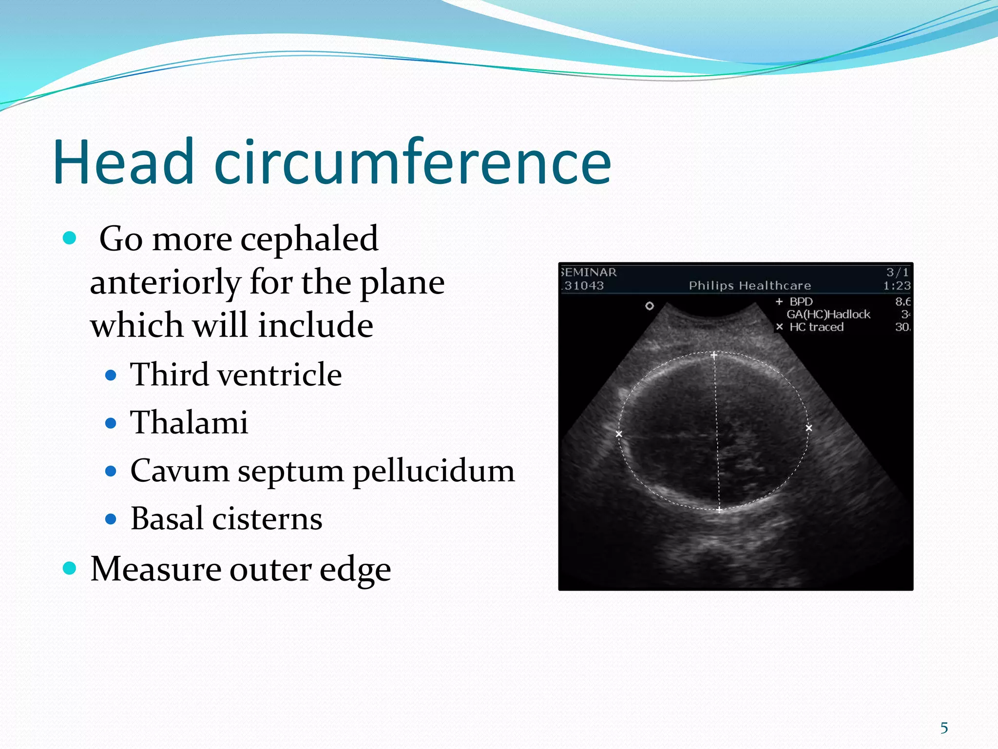 Head circumference
 Go more cephaled
 anteriorly for the plane
 which will include
                              Image
   Third ventricle
   Thalami
   Cavum septum pellucidum
   Basal cisterns
 Measure outer edge



                                      5
 